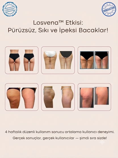 Losvena Şekillendirici - Vücudunun En İyi Halini Keşfet